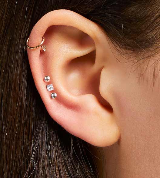 Auricle